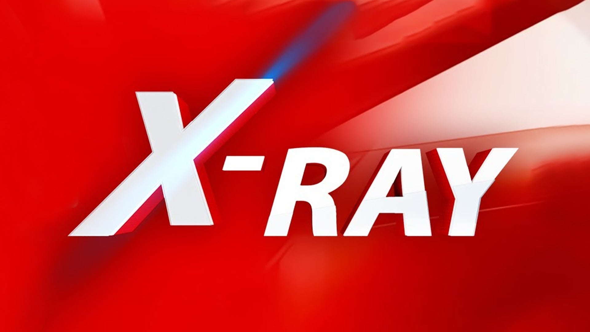 X Ray